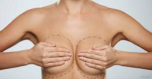 Miami’s Premier Center for Expert Breast Implants